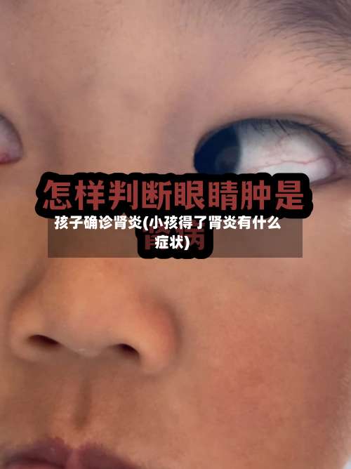 孩子确诊肾炎(小孩得了肾炎有什么症状)