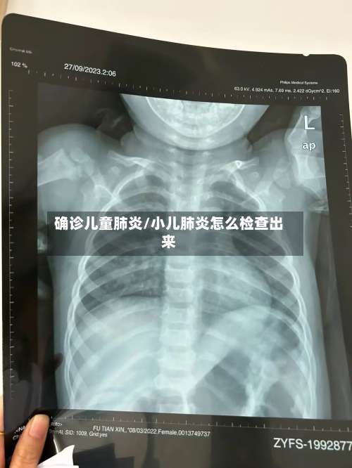 确诊儿童肺炎/小儿肺炎怎么检查出来