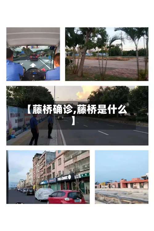 【藤桥确诊,藤桥是什么】-第2张图片