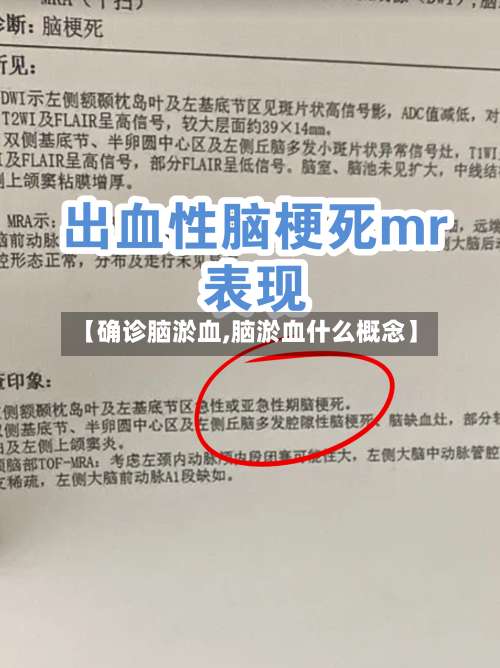 【确诊脑淤血,脑淤血什么概念】