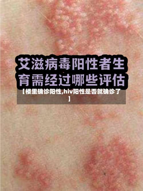 【楼里确诊阳性,hiv阳性是否就确诊了】-第2张图片
