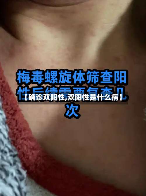 【确诊双阳性,双阳性是什么病】-第2张图片