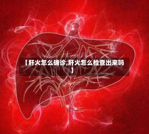 【肝火怎么确诊,肝火怎么检查出来吗】