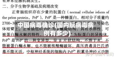中国病毒确诊(国内朊病毒病例有多少)-第2张图片