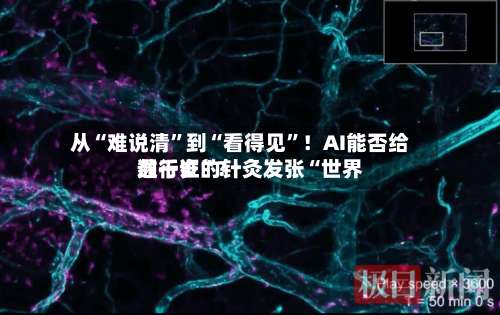 从“难说清”到“看得见”！AI能否给数千岁的针灸发张“世界通行证	”？-第2张图片