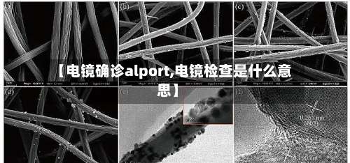 【电镜确诊alport,电镜检查是什么意思】-第3张图片