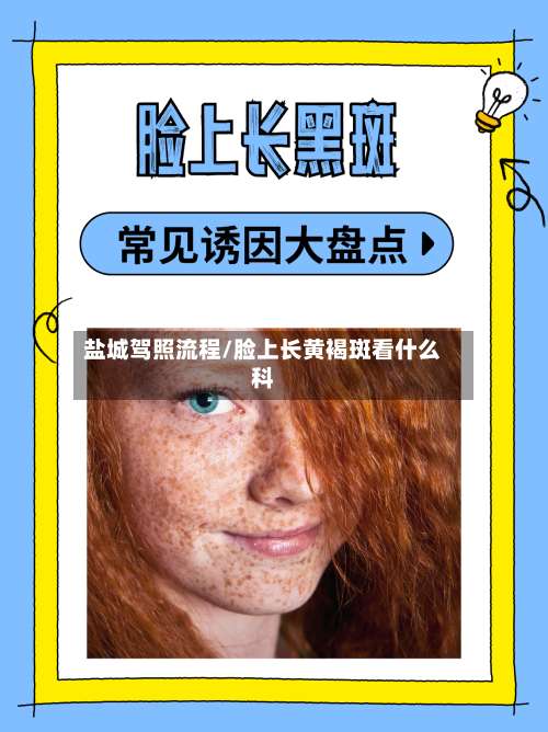 盐城驾照流程/脸上长黄褐斑看什么科