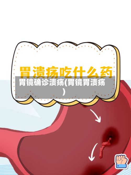 胃镜确诊溃疡(胃镜胃溃疡)