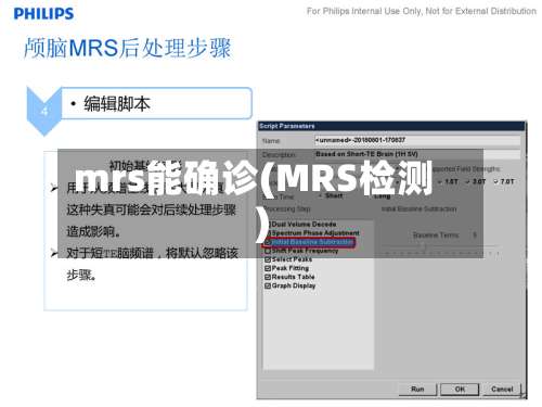 mrs能确诊(MRS检测)-第3张图片