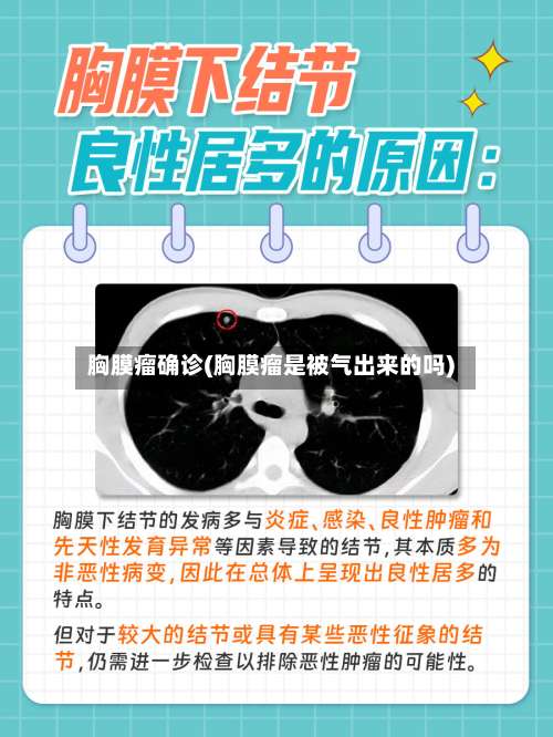 胸膜瘤确诊(胸膜瘤是被气出来的吗)