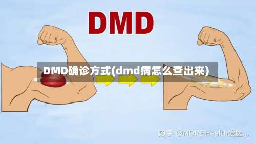 DMD确诊方式(dmd病怎么查出来)
