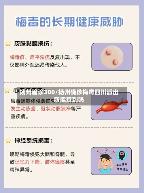 扬州确诊300/扬州确诊梅毒四川派出所能查到吗-第3张图片