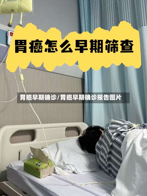 胃癌早期确诊/胃癌早期确诊报告图片
