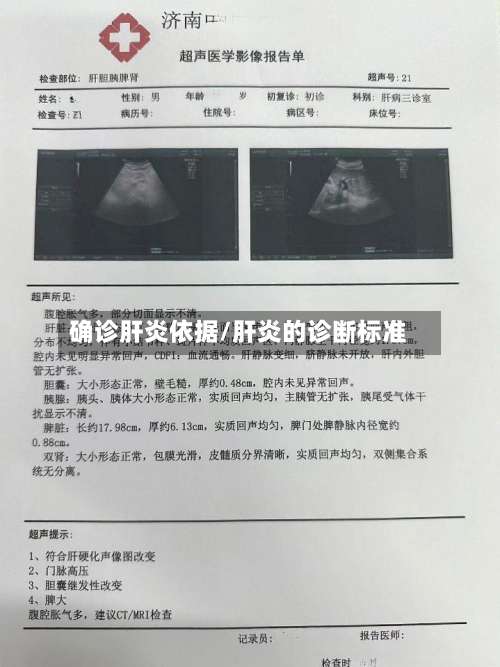 确诊肝炎依据/肝炎的诊断标准-第2张图片