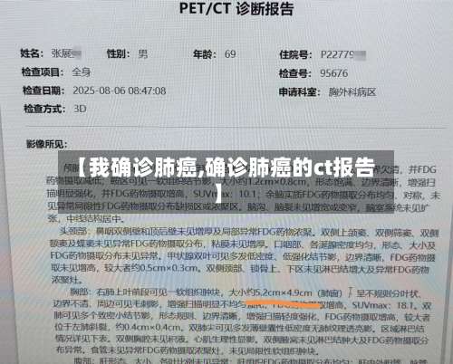 【我确诊肺癌,确诊肺癌的ct报告】-第2张图片